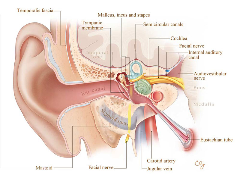 Otosclerosis and stapes surgery — Hearing Institute